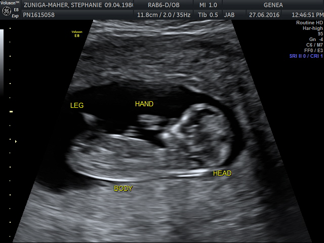 BABY 12 WEEKS_17 labelled